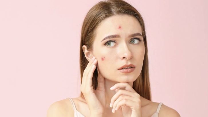 Top-Rated Acne Clinic in Lexington Park Maryland
